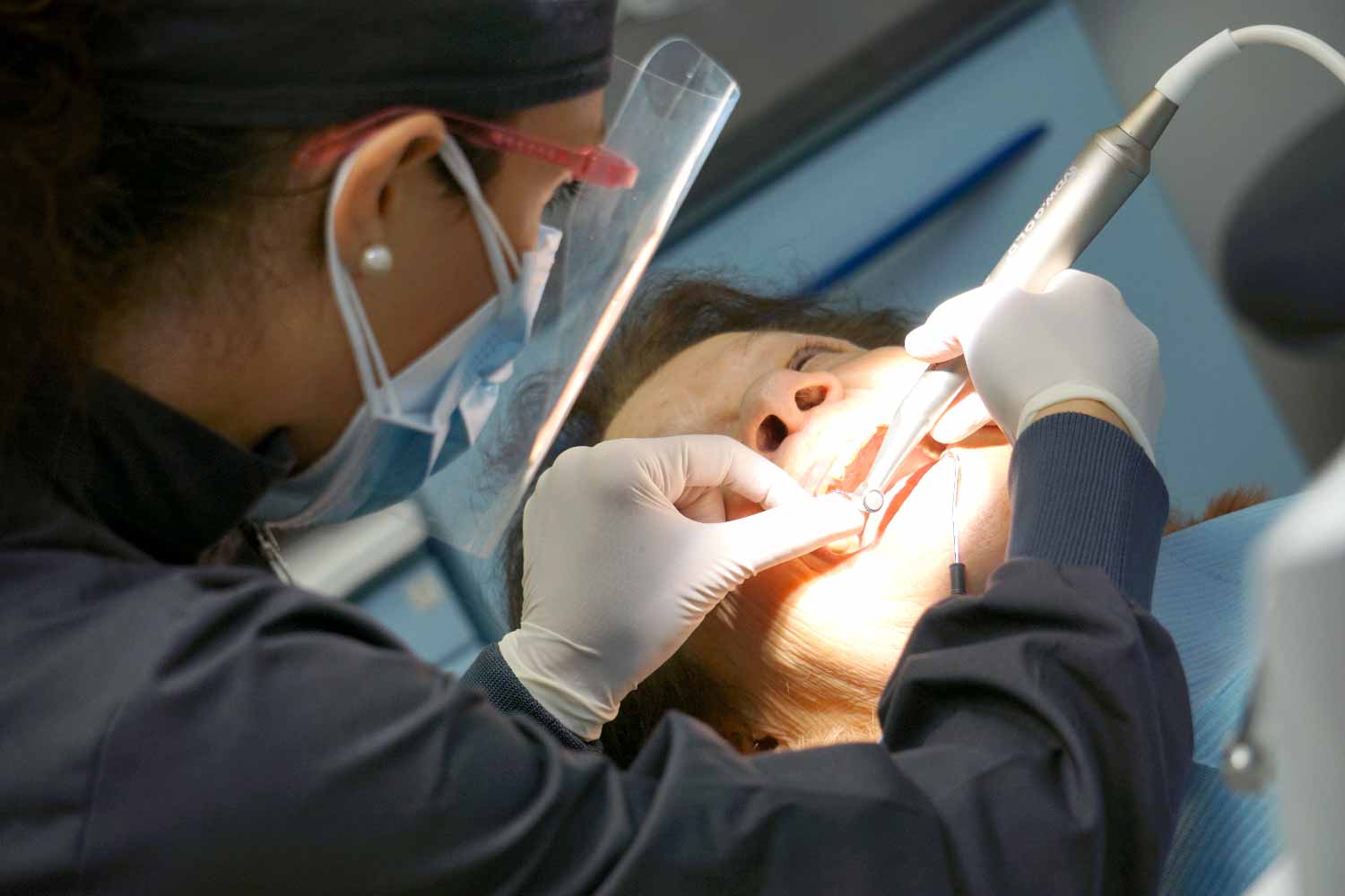 Estrazioni Dente Del Giudizio Dentista Roma Tuscolana